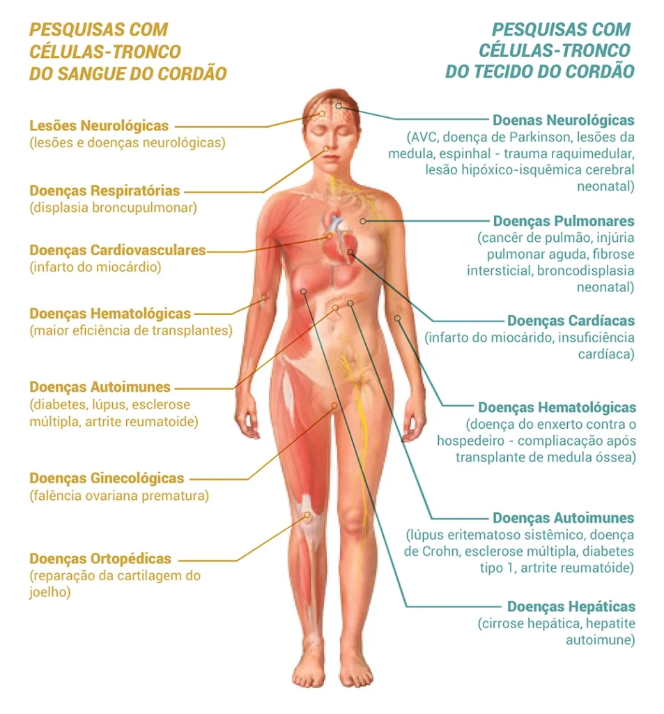 Ilustração de corpo humano com lista de pesquisas com células-tronco