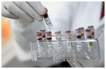 Imagem de frascos de amostras de sangue